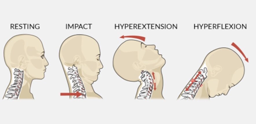 different neck positions