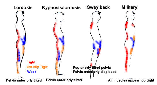 Posture types