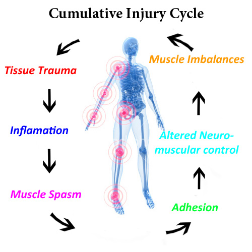 image of skeleton with stages of cummulative injury cycle