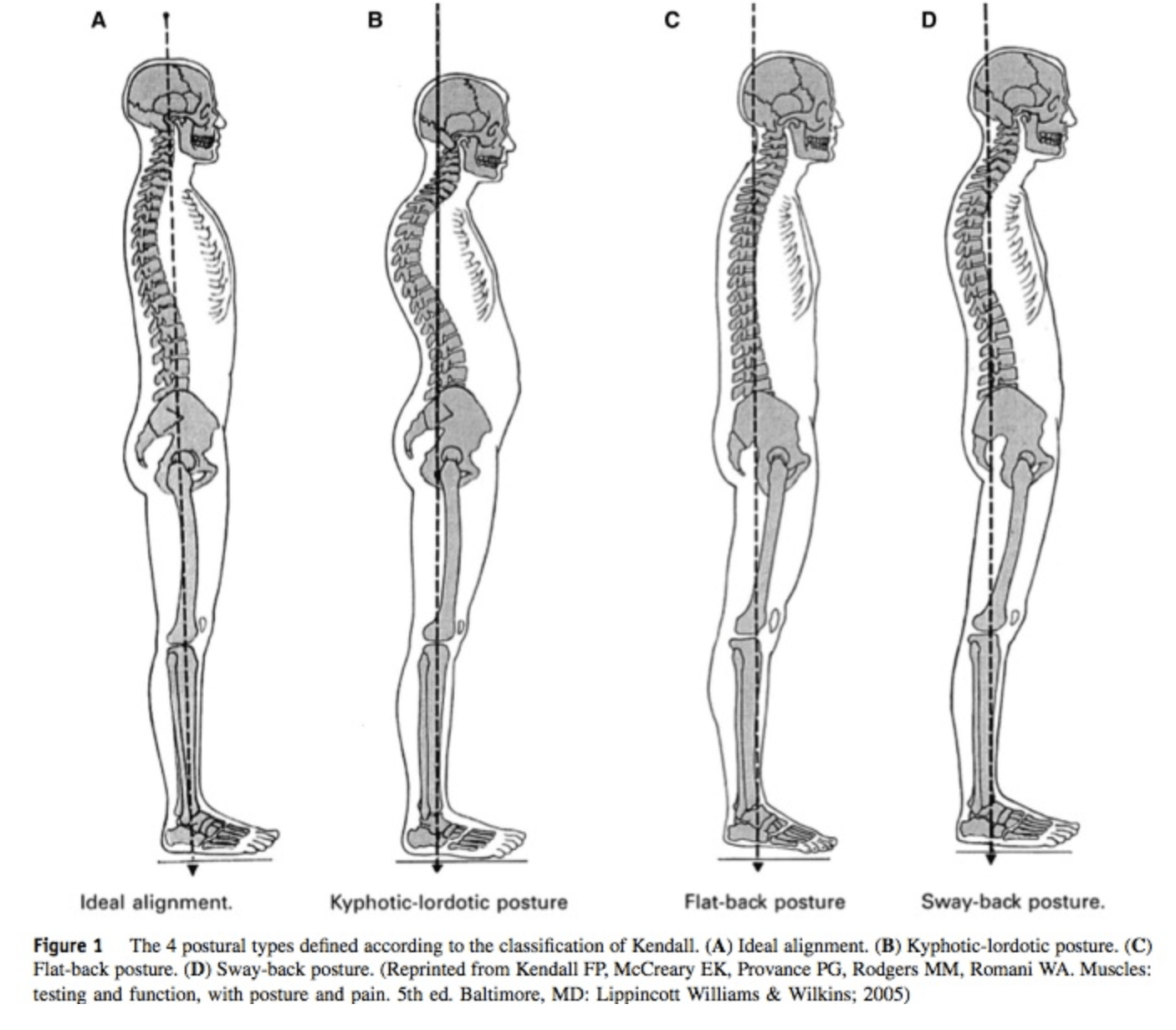 side view of skeletons standing with different types of posture