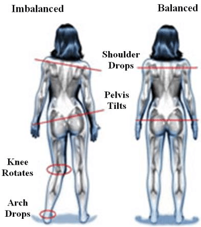 two images of an invisible body from the posterior, one with muscle imbalanced, one without.