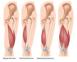 anatomical image of hamstrings, normal and tight