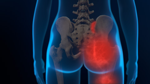 posterior view of the si joint and the area of pain is highlights